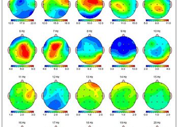What can a QEEG Brain Map tell you?